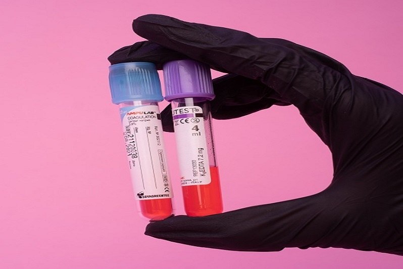 Ci si deve sottoporre a delle visite di routine come le analisi del sangue.
