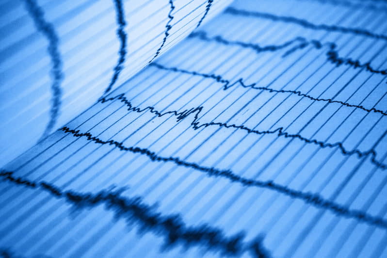 L'elettrocardiogramma è uno degli esami da fare per ottenere il certificato di idoneità psicofisica